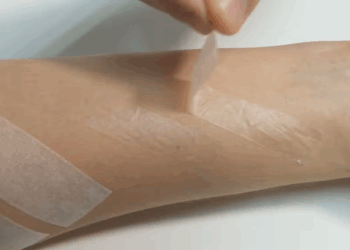 Curativo à base de cana-de-açúcar ajuda na recuperação de pacientes após cirurgia de varizes